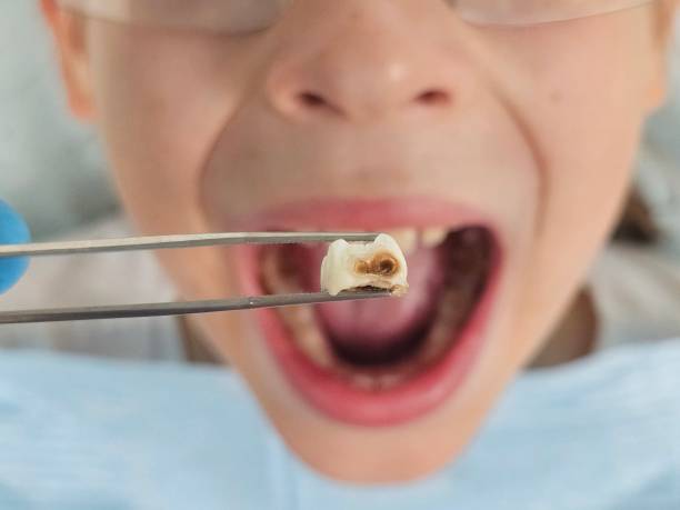 Best Emergency Care for Gum Disease in Old Tappan, NJ